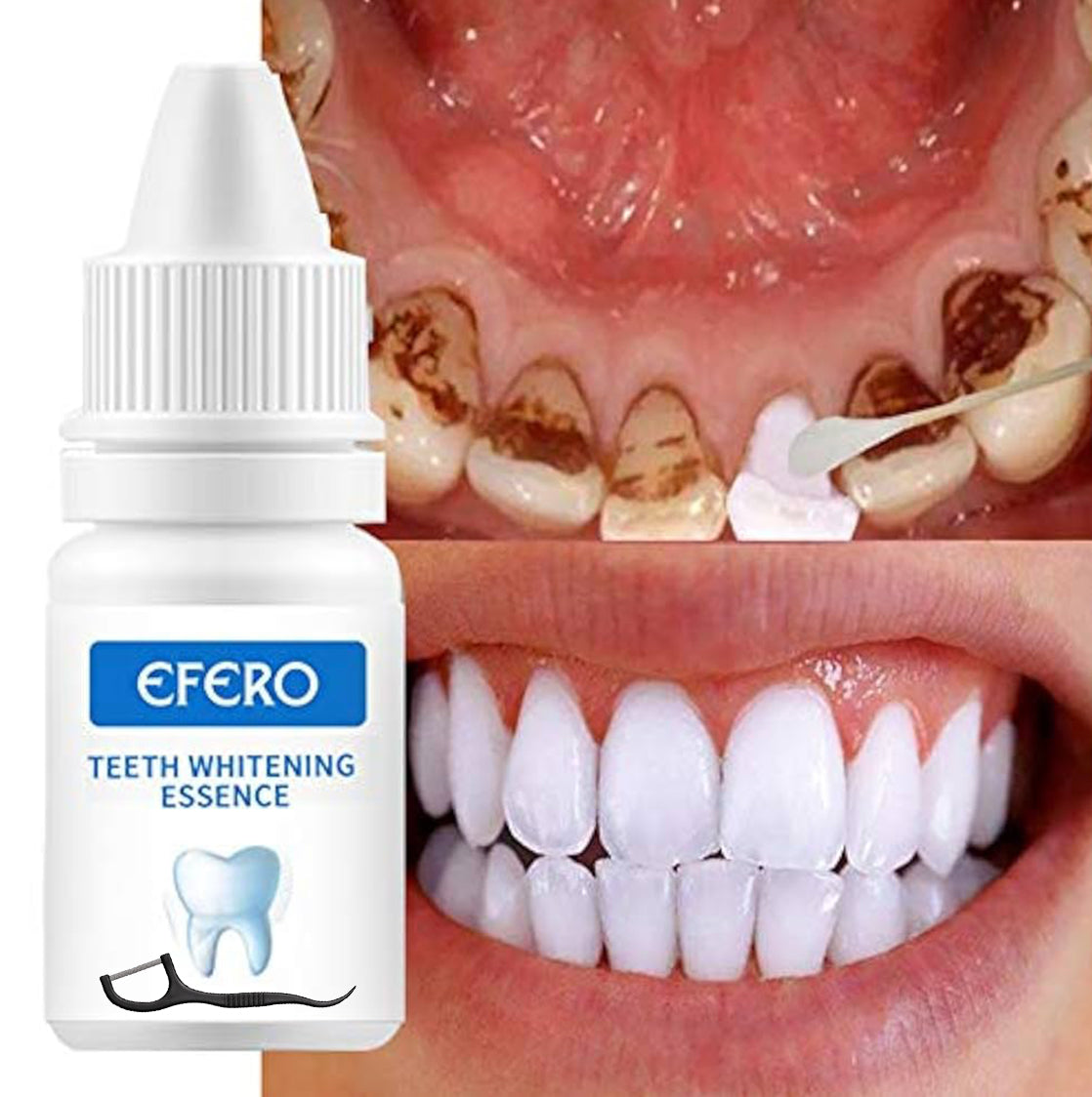 Pack de blanchiment des Dents EFERO Sérum Hygiène Plaque Retains 10 ML avec deux types de fil dentaire et 40 cotons-tiges, Dents Plus Blanches avec Un sac à cordon