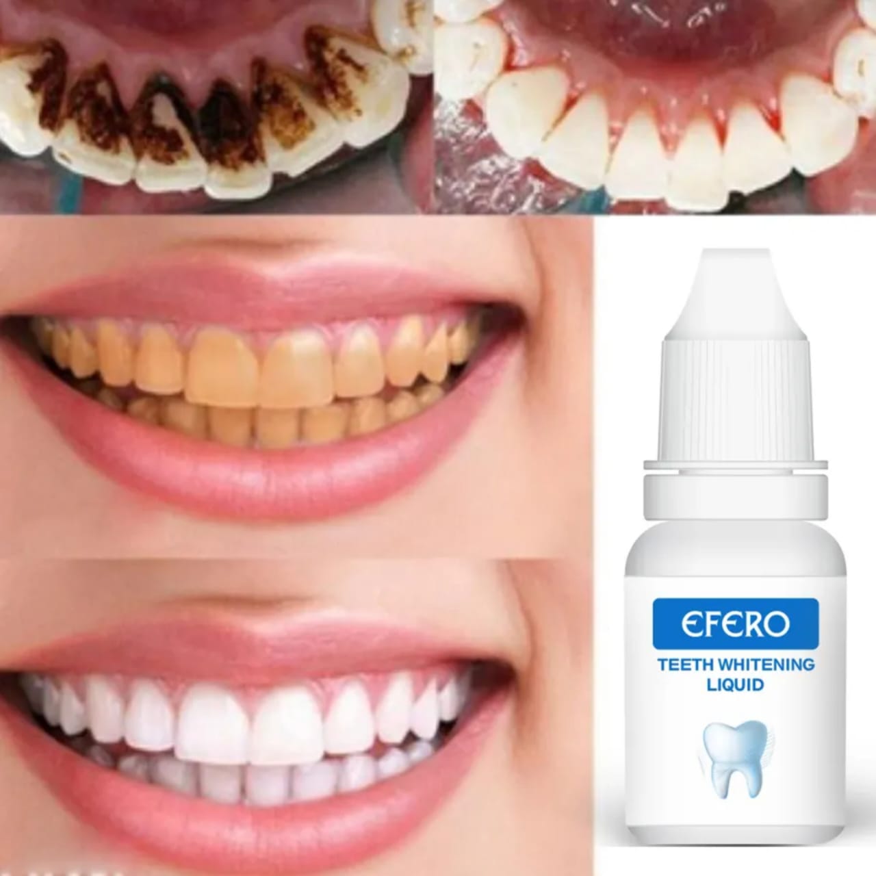 Pack de blanchiment des Dents EFERO Sérum Hygiène Plaque Retains 10 ML avec deux types de fil dentaire et 40 cotons-tiges, Dents Plus Blanches avec Un sac à cordon